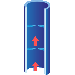 varices-valvules-ouvertes Valvules fermées : pas de reflux vers le bas